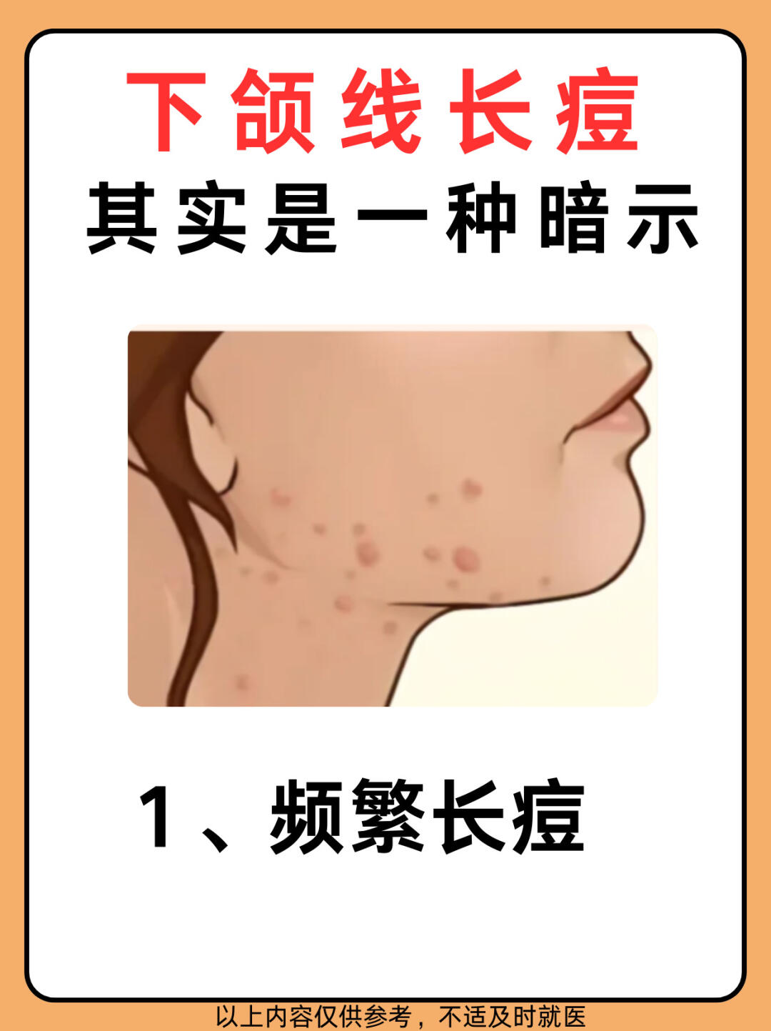 百货# 一般都出现在20 的姐妹,集中下颌线爆发,下颚线一旦开始长痘