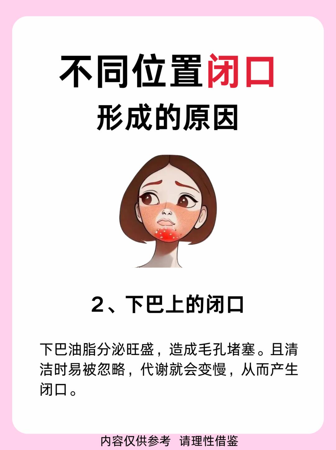 为什么脸上长闭口反反复复为什么在线 为什么脸上长闭口反反复复为什么在线