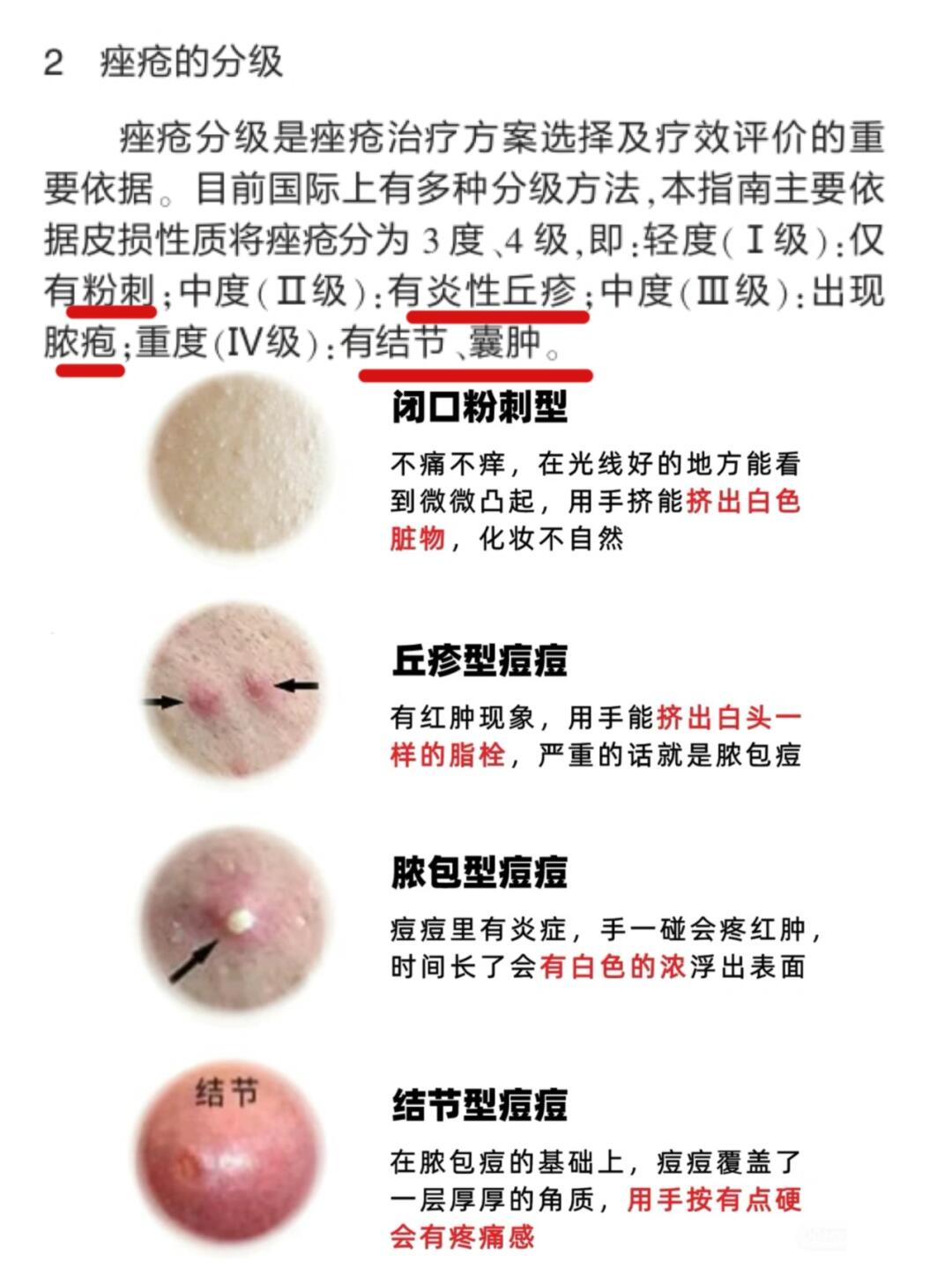 为什么老长痘 为什么老长痘