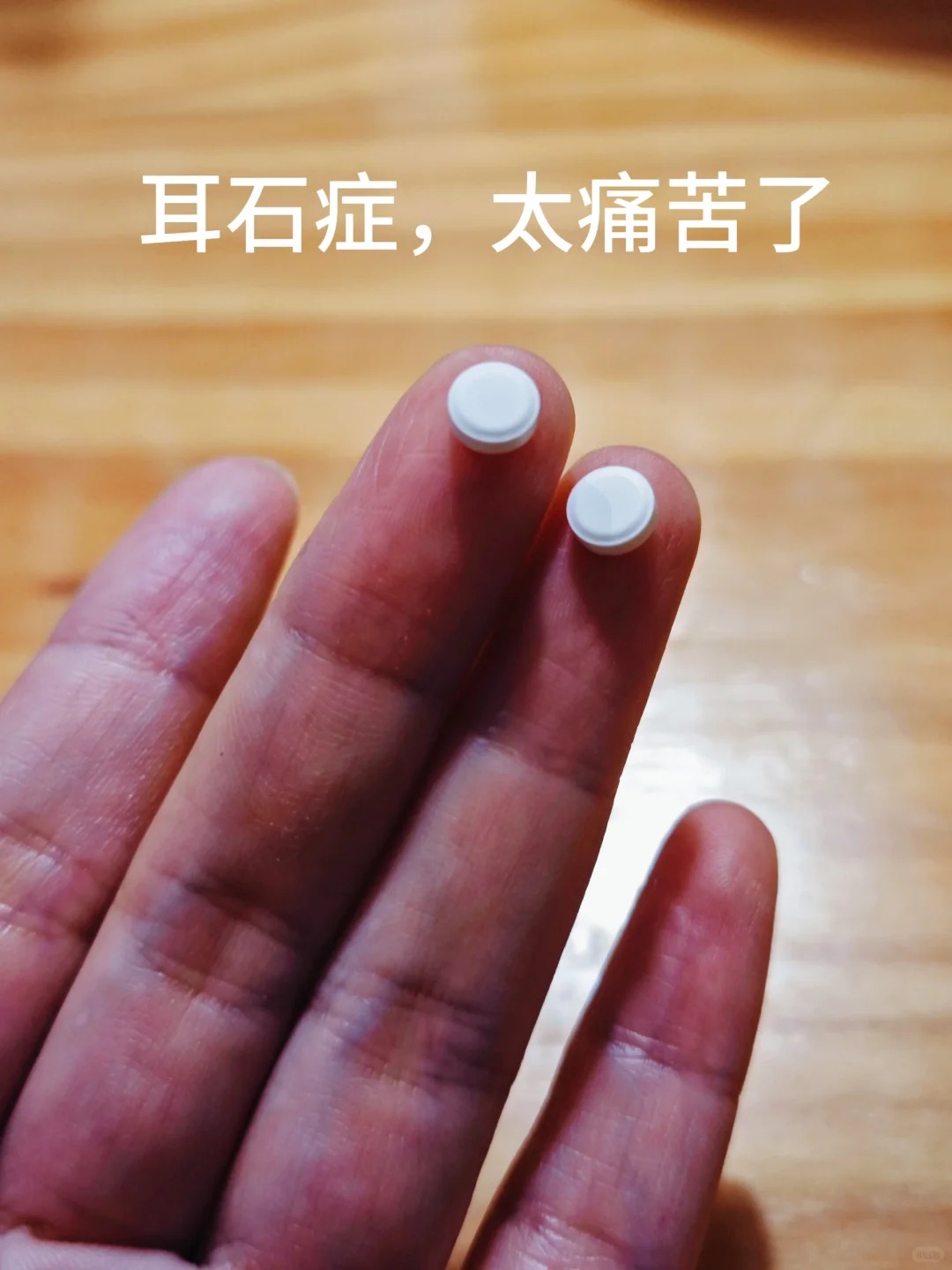早上起来头眩晕是怎么回事