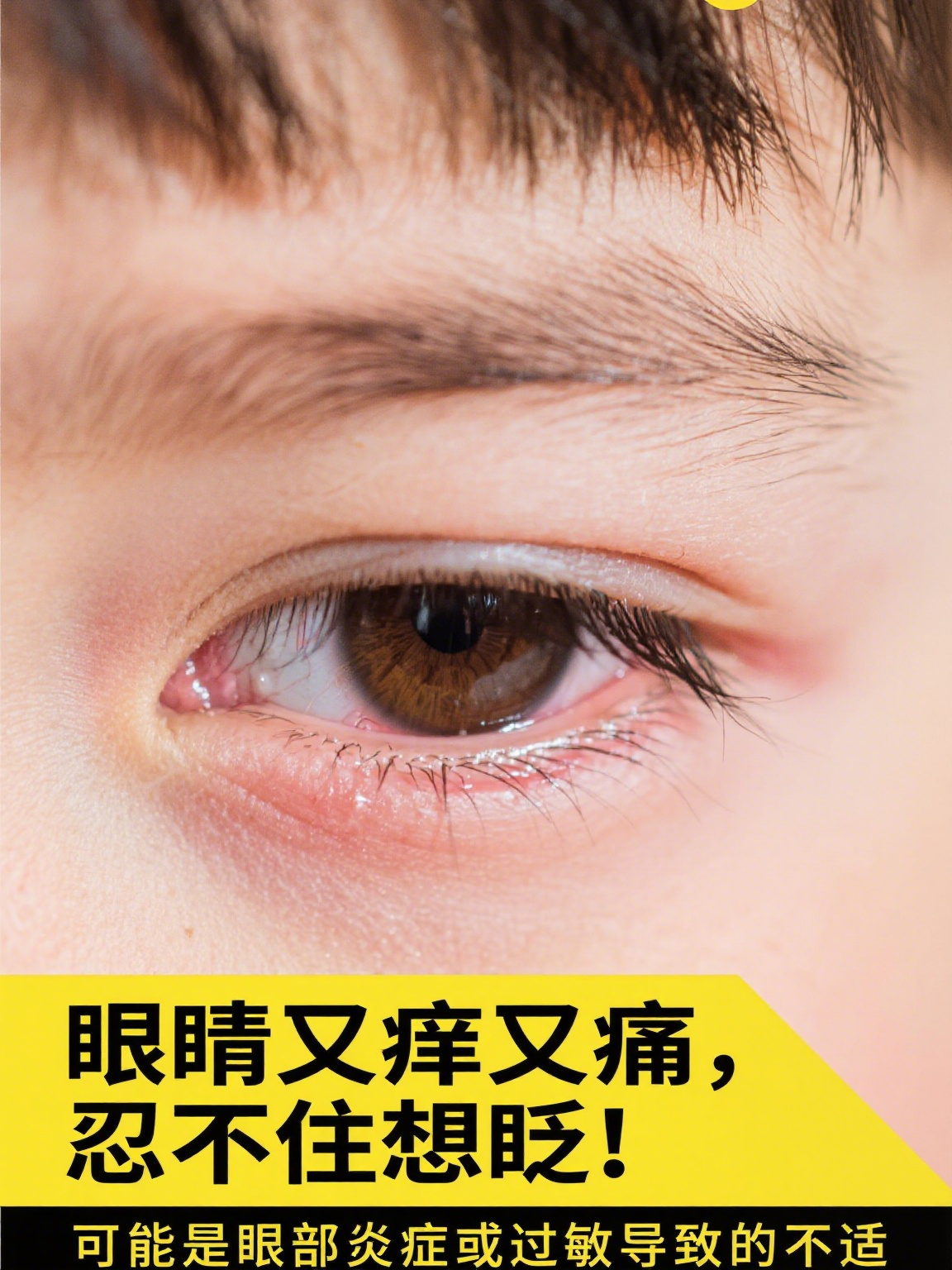 孩子频繁眨眼的六种原因