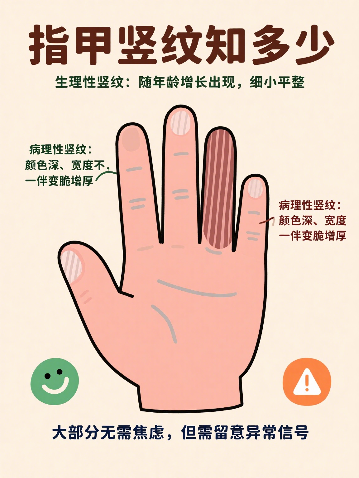 指甲有竖纹是身体的什么原因 很多人偶然发现指甲上出现竖纹时,都会