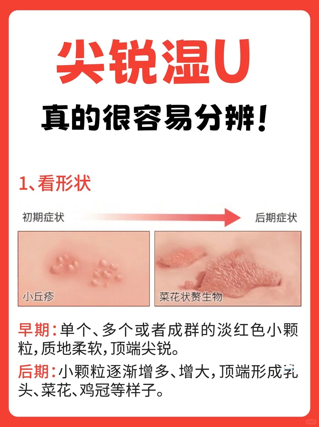 尖锐刚开始长出来的样子