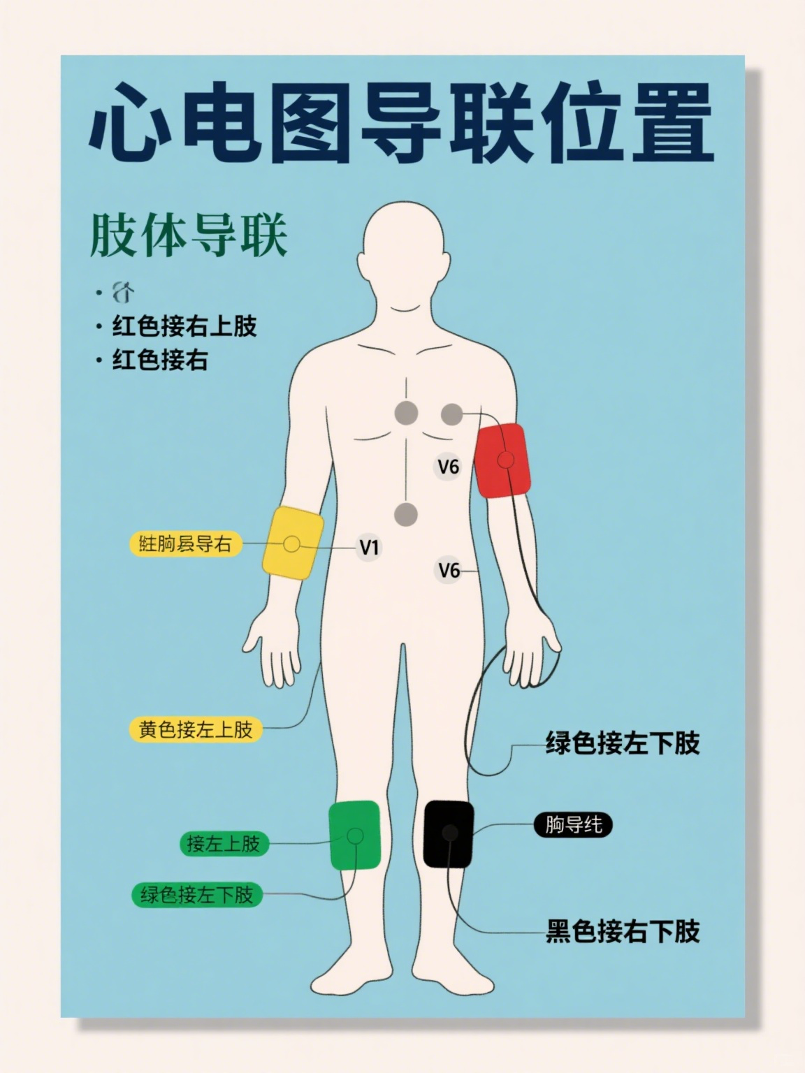 心电图是记录心脏电活动的重要检查,而导联位置的