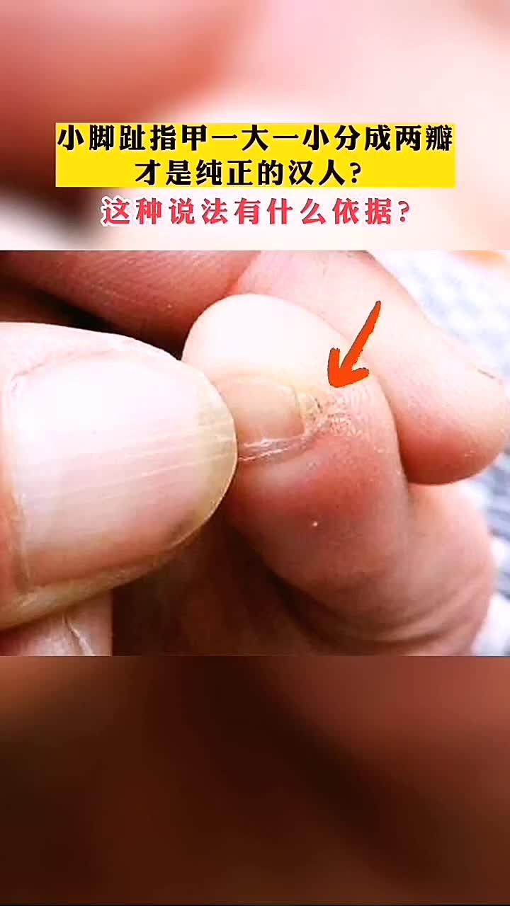 小脚趾甲大小不一且分开成两瓣的原因分析