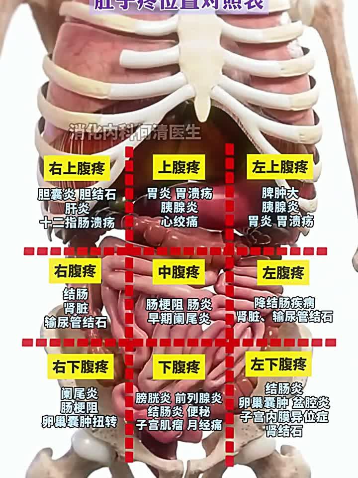 肚子疼位置对照表,10秒学会自查