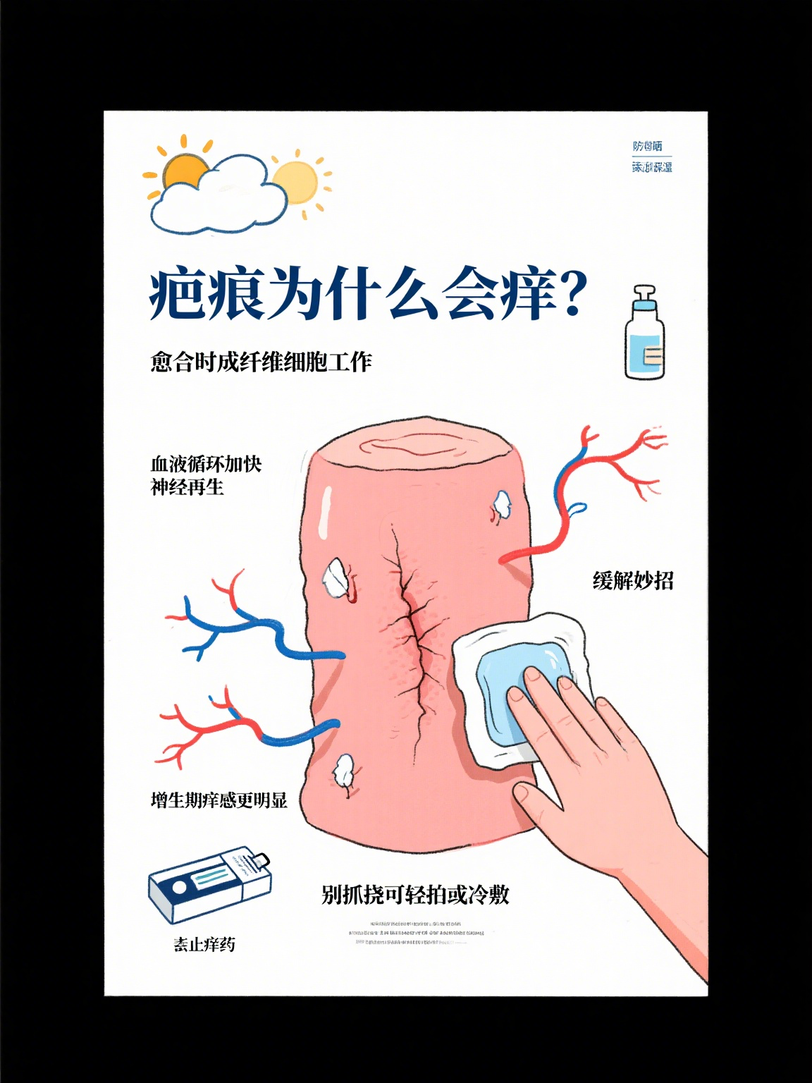 疤痕痒是什么原因 疤痕发痒是伤口愈合过程中常见的现