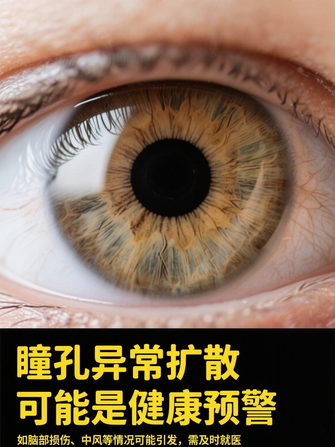 瞳孔扩散,指的是眼睛虹膜中间的圆孔