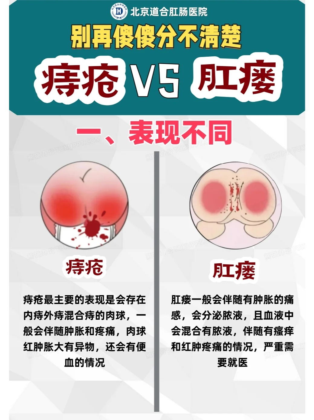 患上肛瘘后,最常见的症状是肛门周