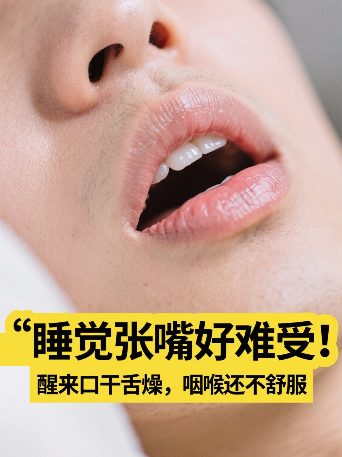 为什么睡觉张着嘴