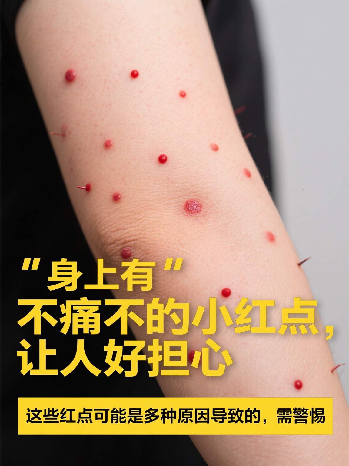 小红点像血点不痛不痒图片 身上突然出现像血点一样的小红点,不痛也