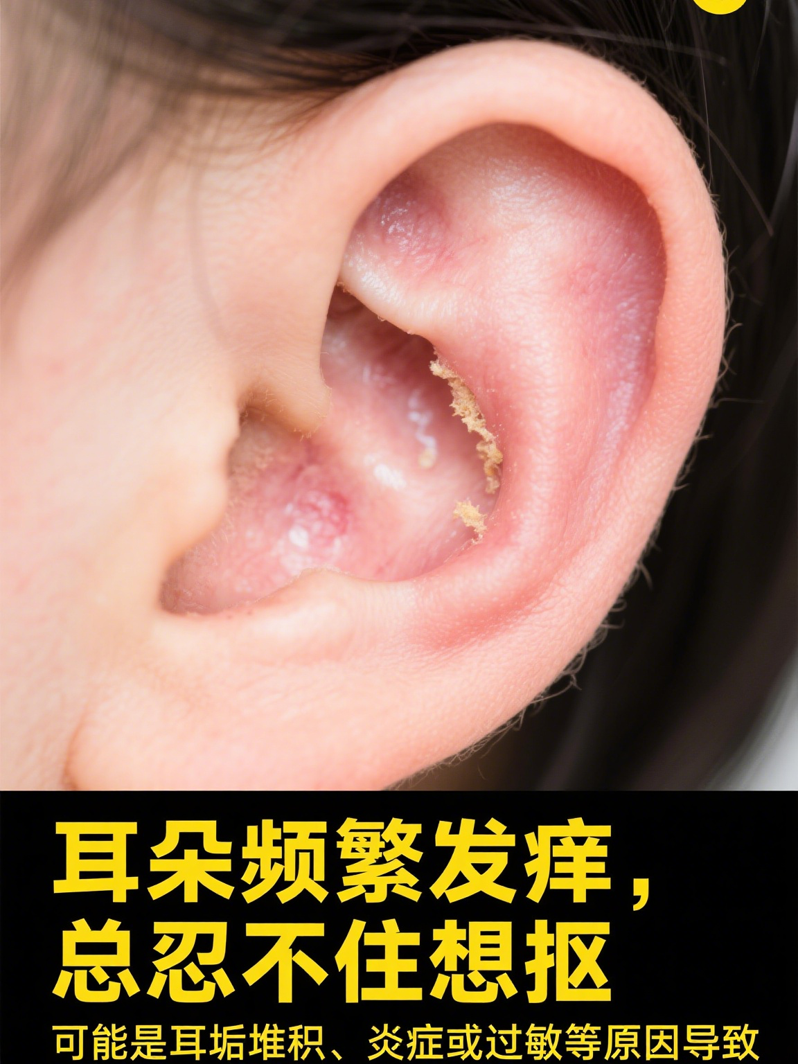 耳朵痒痒老想抠的怎么回事 耳朵频繁发痒总忍不住想抠,可能是这几个