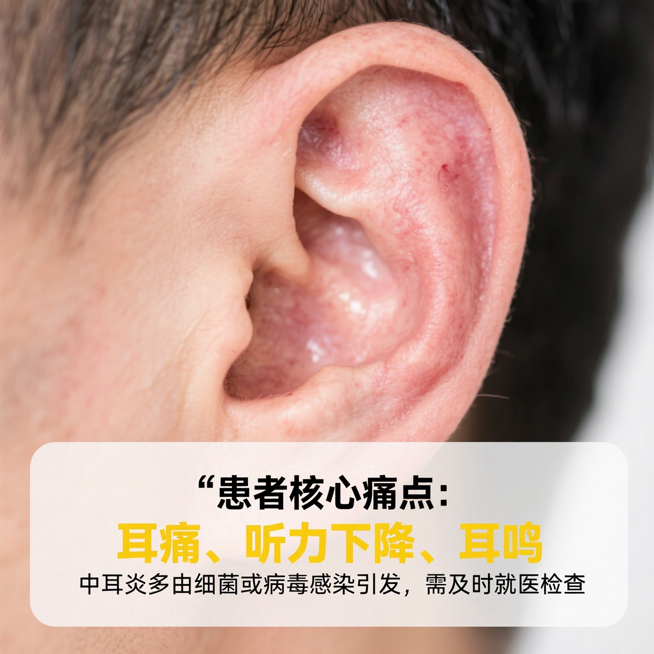 耳鼻喉作为人体的重要器官,一旦出现问题,会给生活