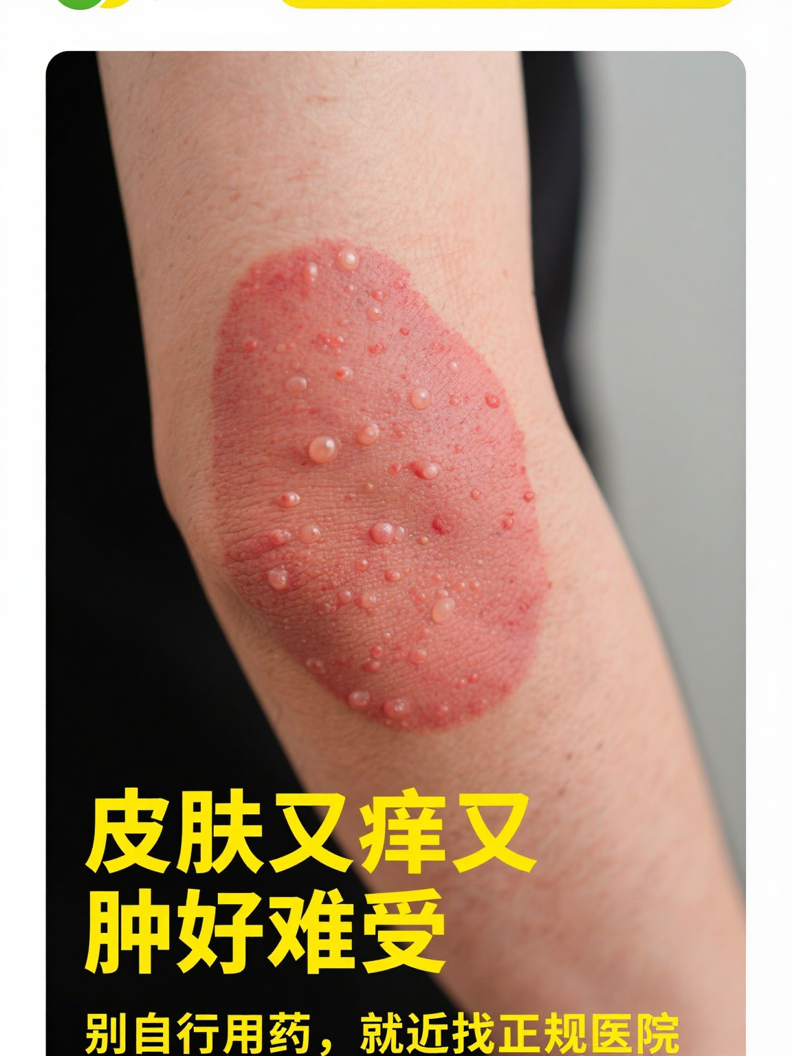 附近皮肤医院离我位置最近的