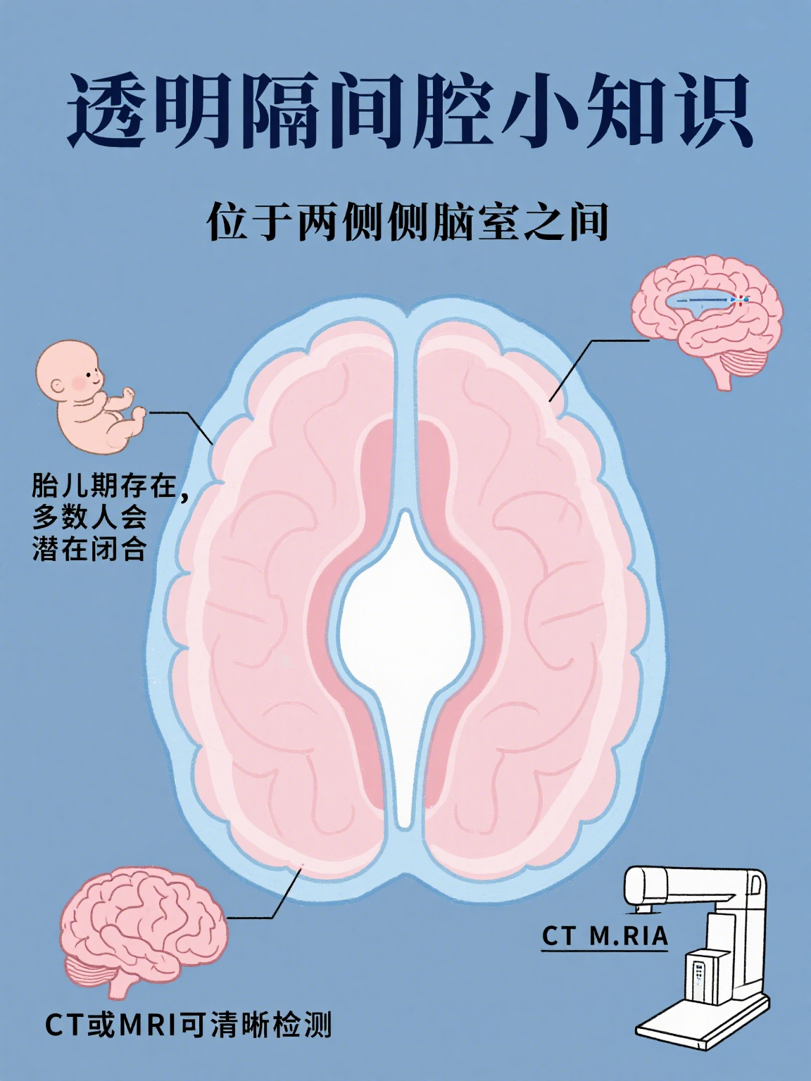 透明隔间腔 透明隔间腔是大脑内一个潜在的腔隙,位于两侧侧脑室之间
