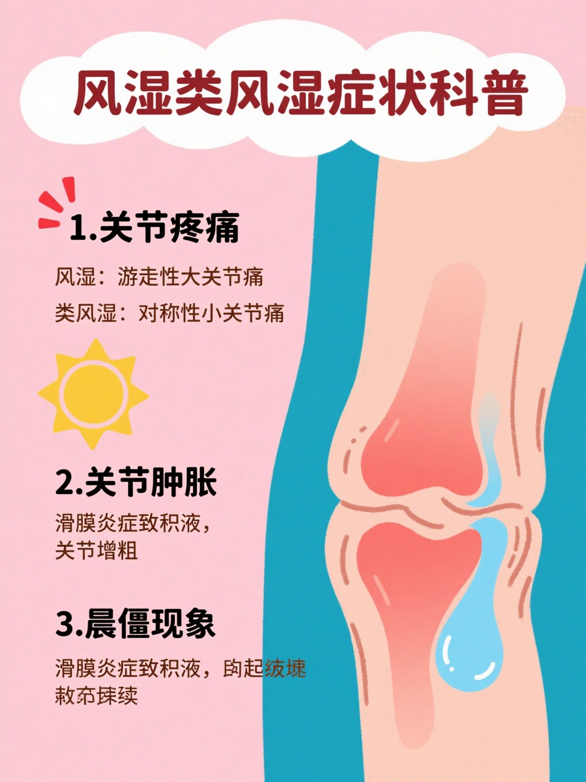 风湿类风湿有什么症状表现