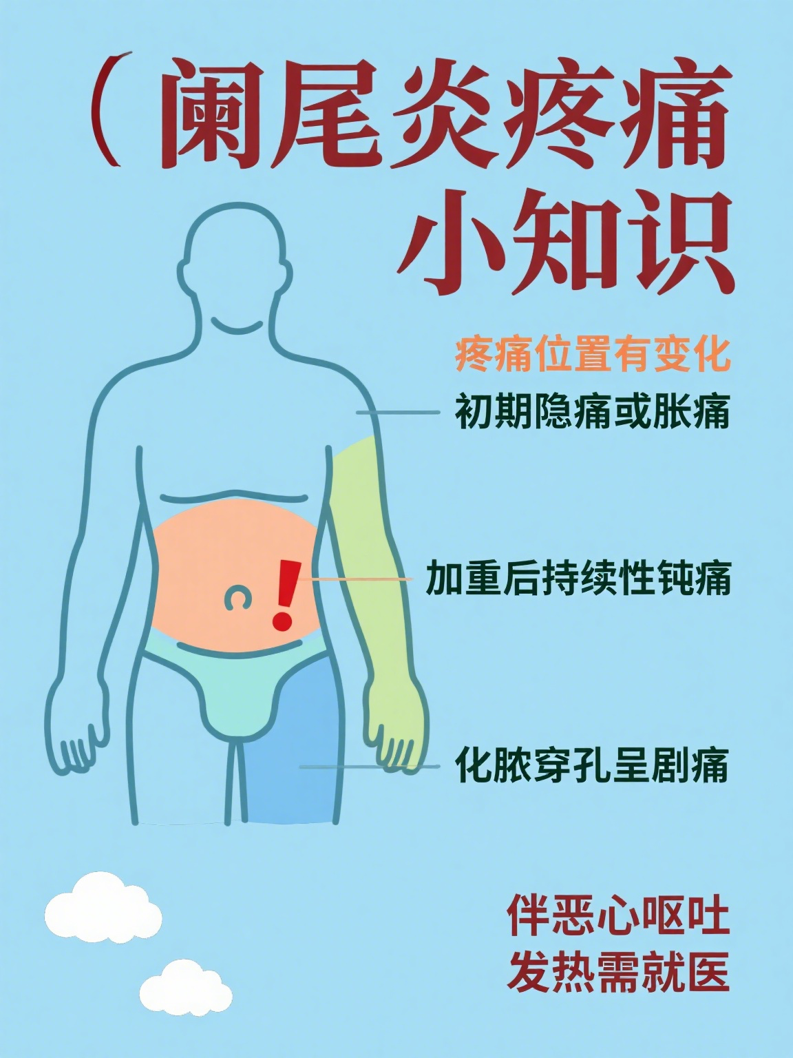 阑尾炎是哪个部位疼