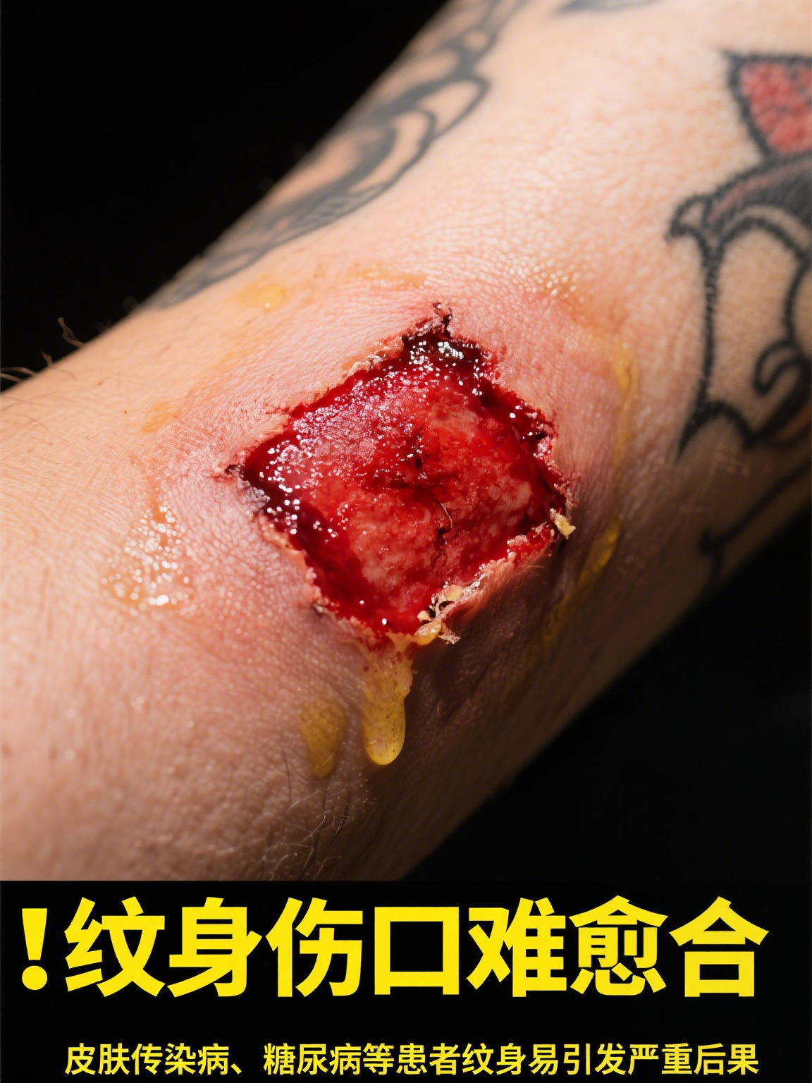 千目修罗纹身图片 千目修罗纹身,是融合神秘与个性的独特存在