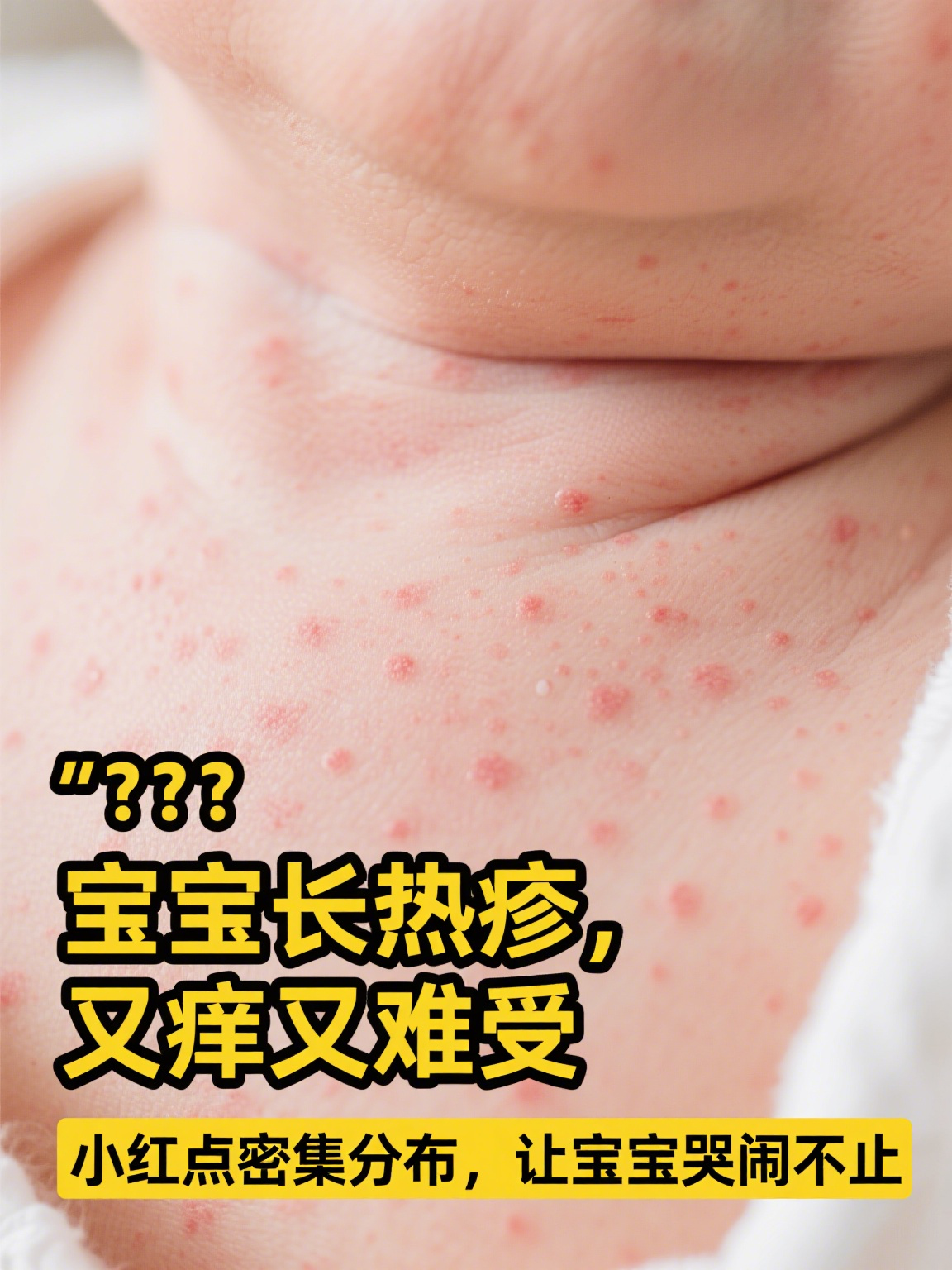 的热疹什么样子宝宝身上疹子图片婴儿皮肤小红点点四个月宝宝热疹图片