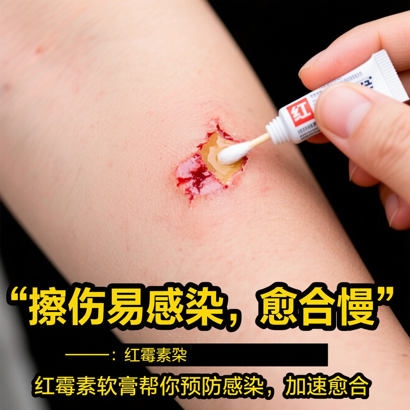 在日常皮肤护理和小病小痛处理红霉素软膏伤口用了抗生素药膏过敏