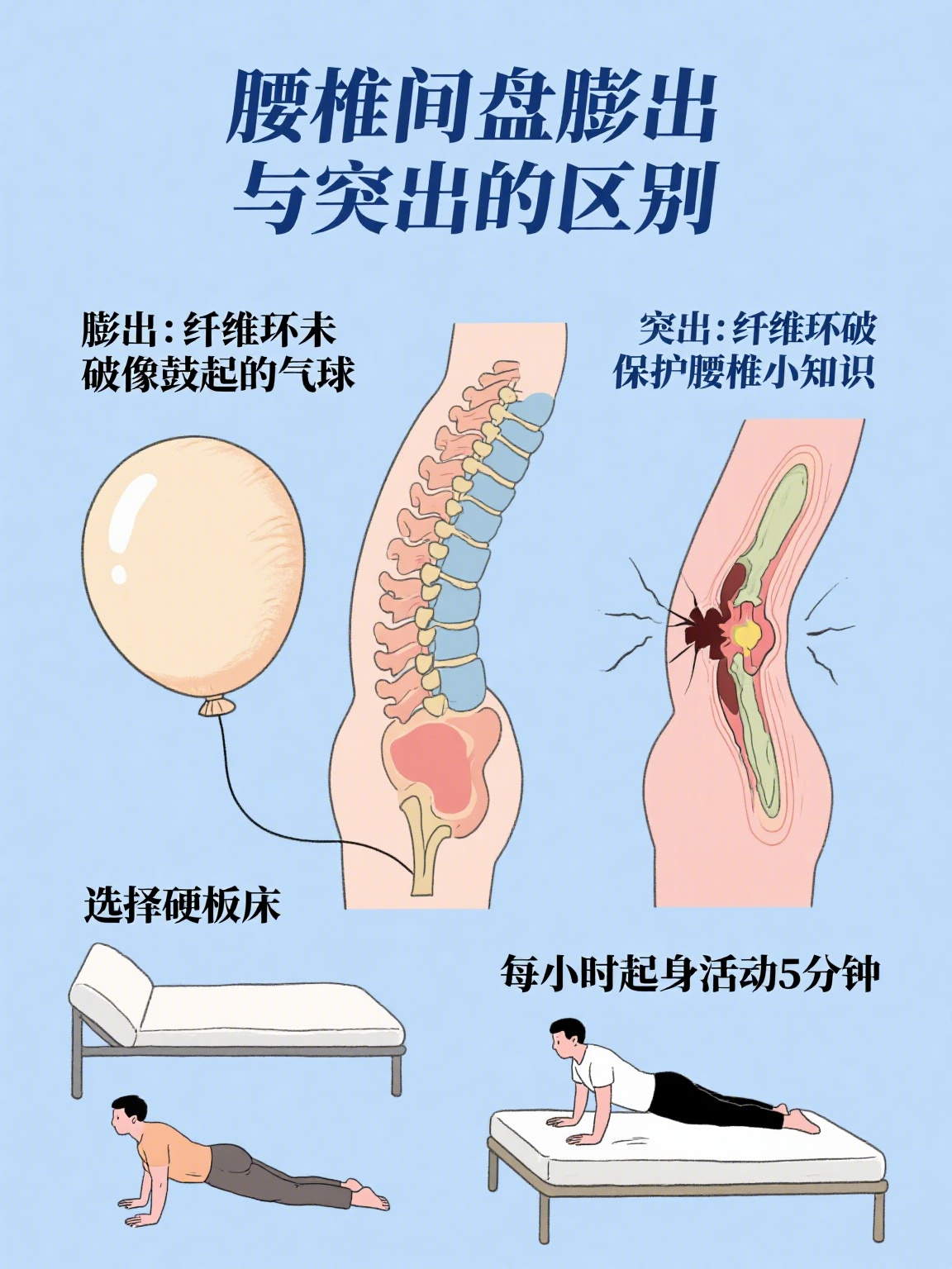 腰椎间盘膨出突出 腰椎间盘膨出和突出都是常见的腰椎问题,但二者有