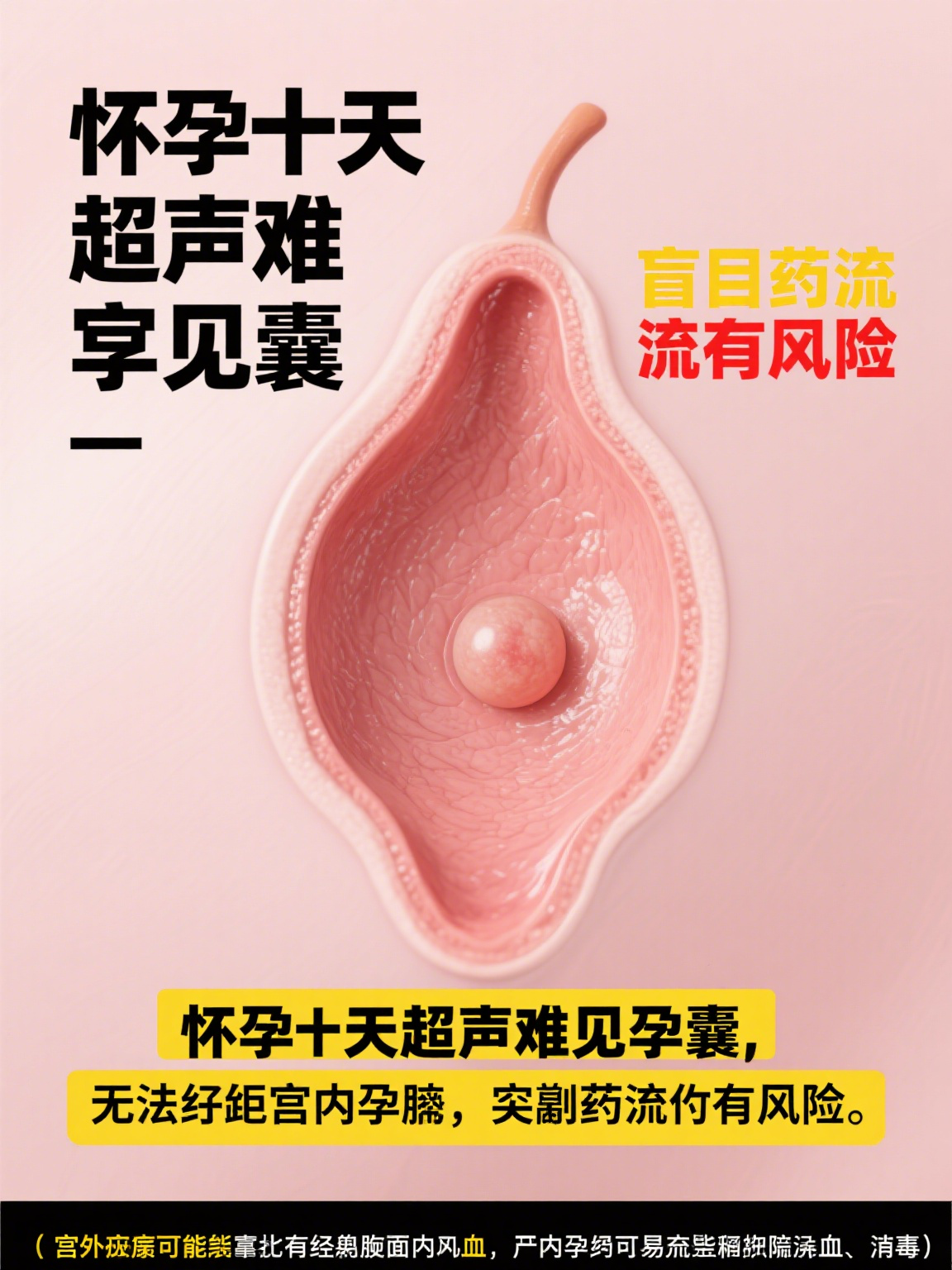 🏈最新消息网上能买到流产的药吗分享(你知道网上买的流产药能吃吗吗？)