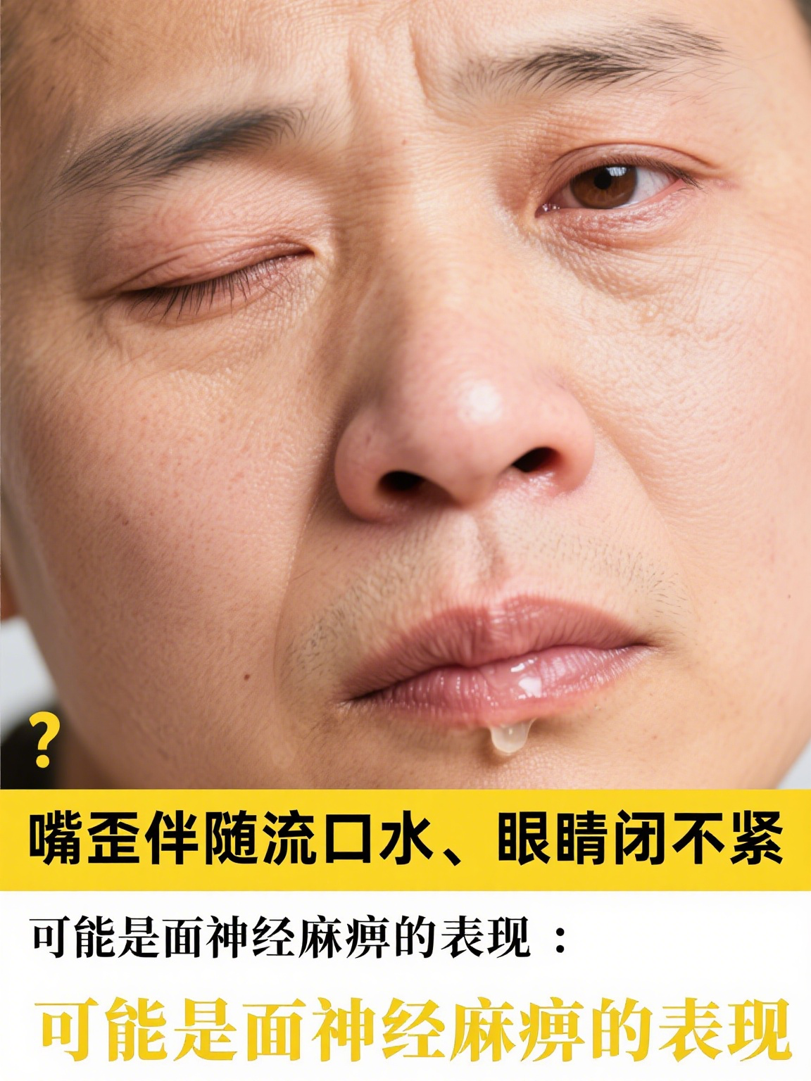 嘴为什么会歪 嘴为什么会歪