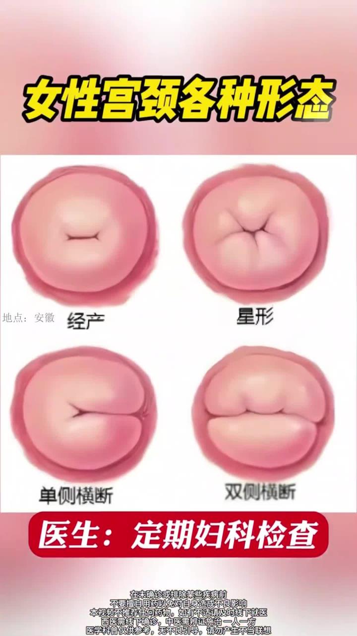 女性宫颈的各种形态