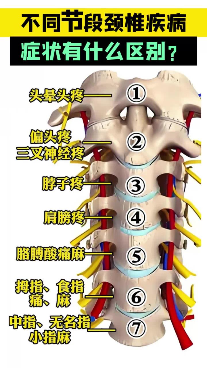 不同节段颈椎疾病,症状有哪些区别?