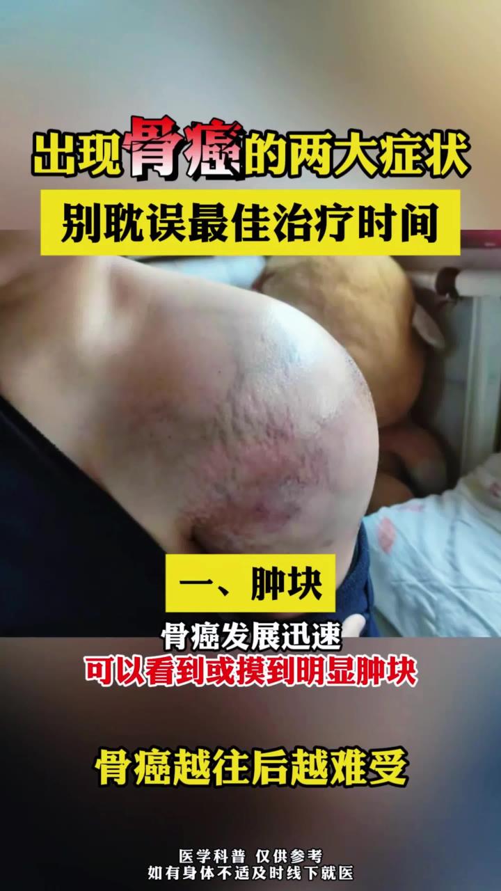 为什么会得骨癌