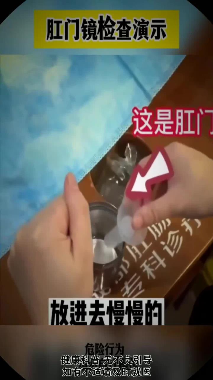 肛门镜检查演示