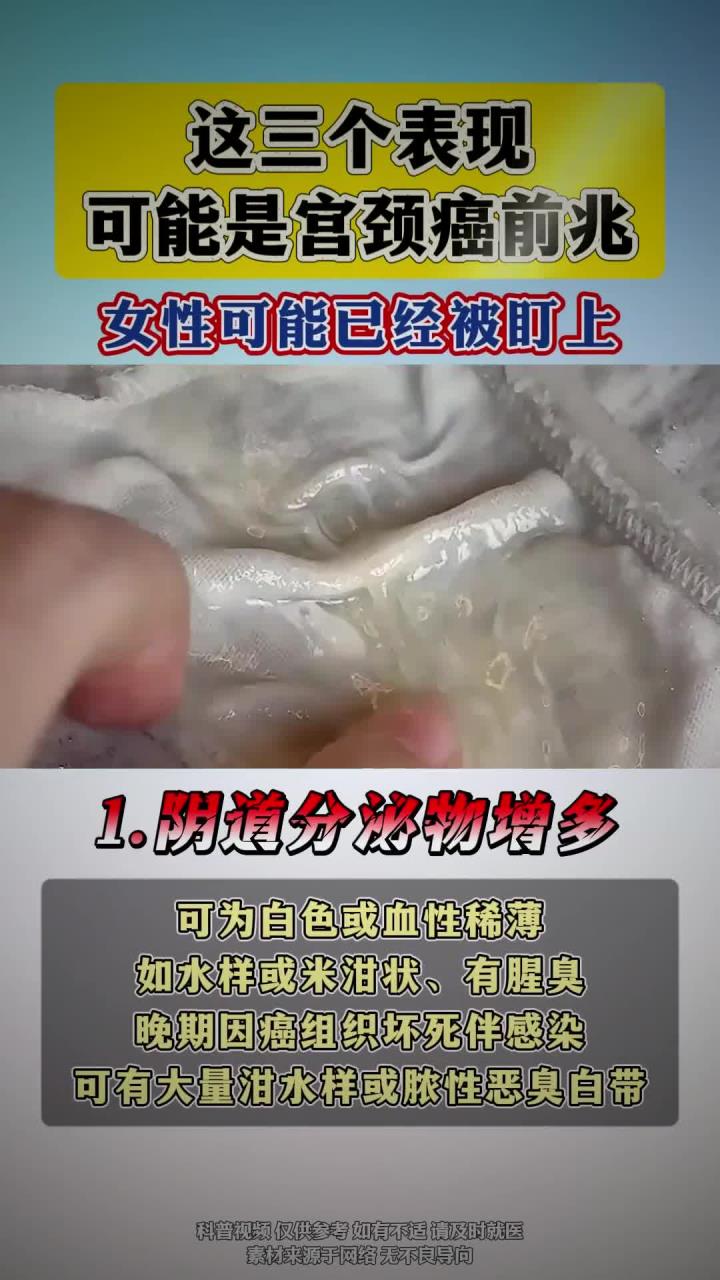 这三个表现,可能是宫颈癌前兆