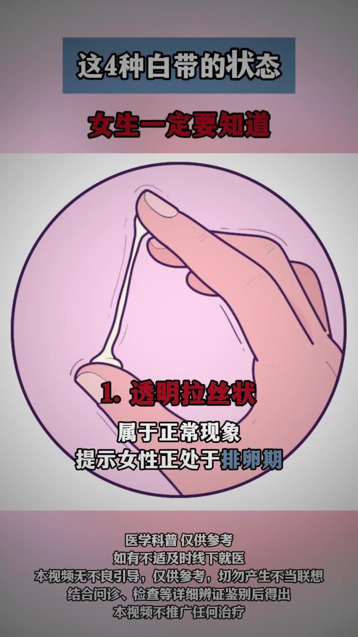 这4种白带的状态,女生一定要知道!