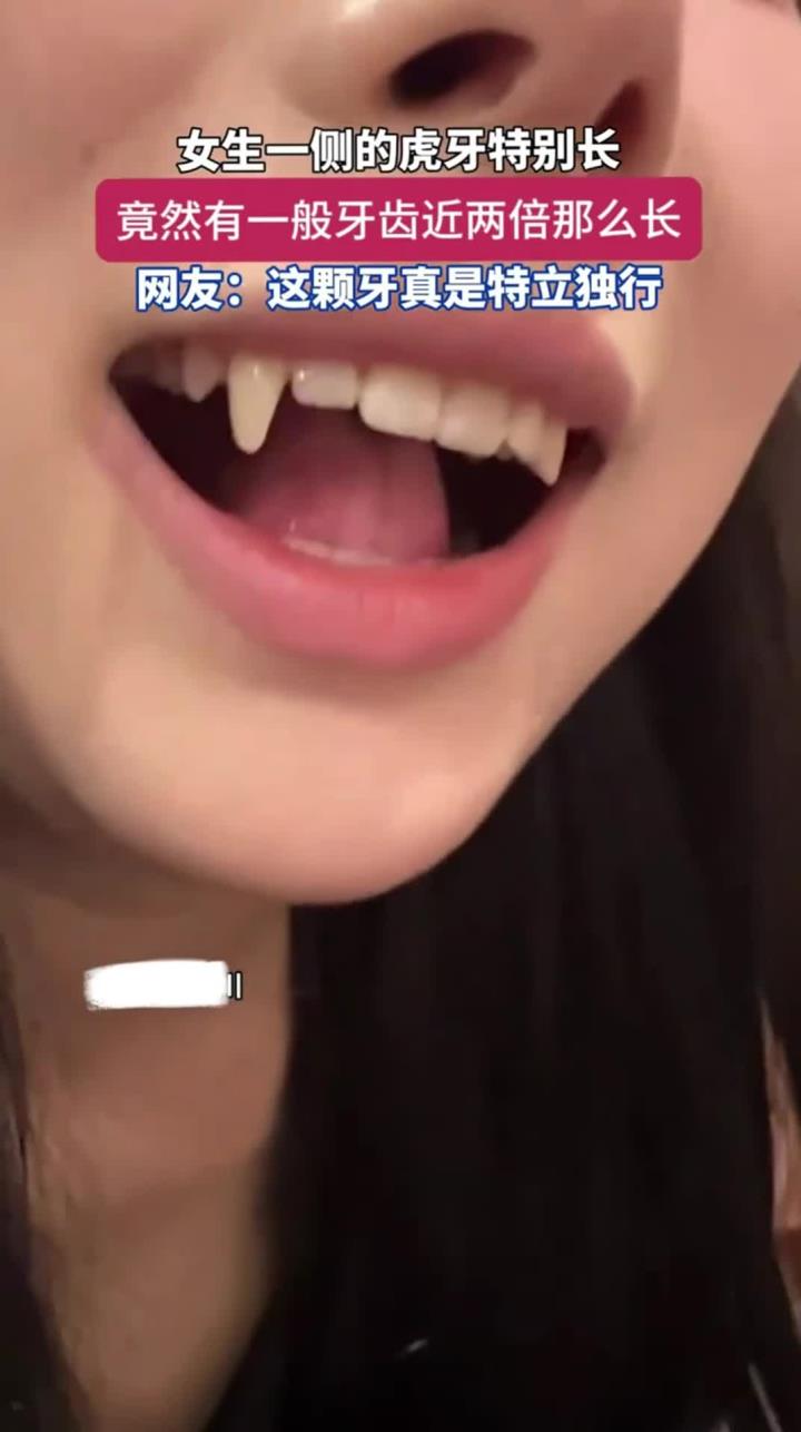 女生一侧的虎牙特别长,有着一般牙齿近两倍的长度