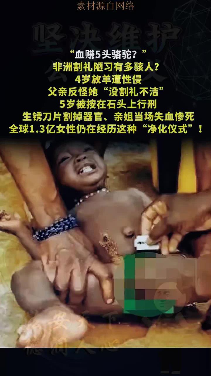 法律解读-非洲割礼陋习:5岁女童遭酷刑,亲姐当场丧命,为何不废除?