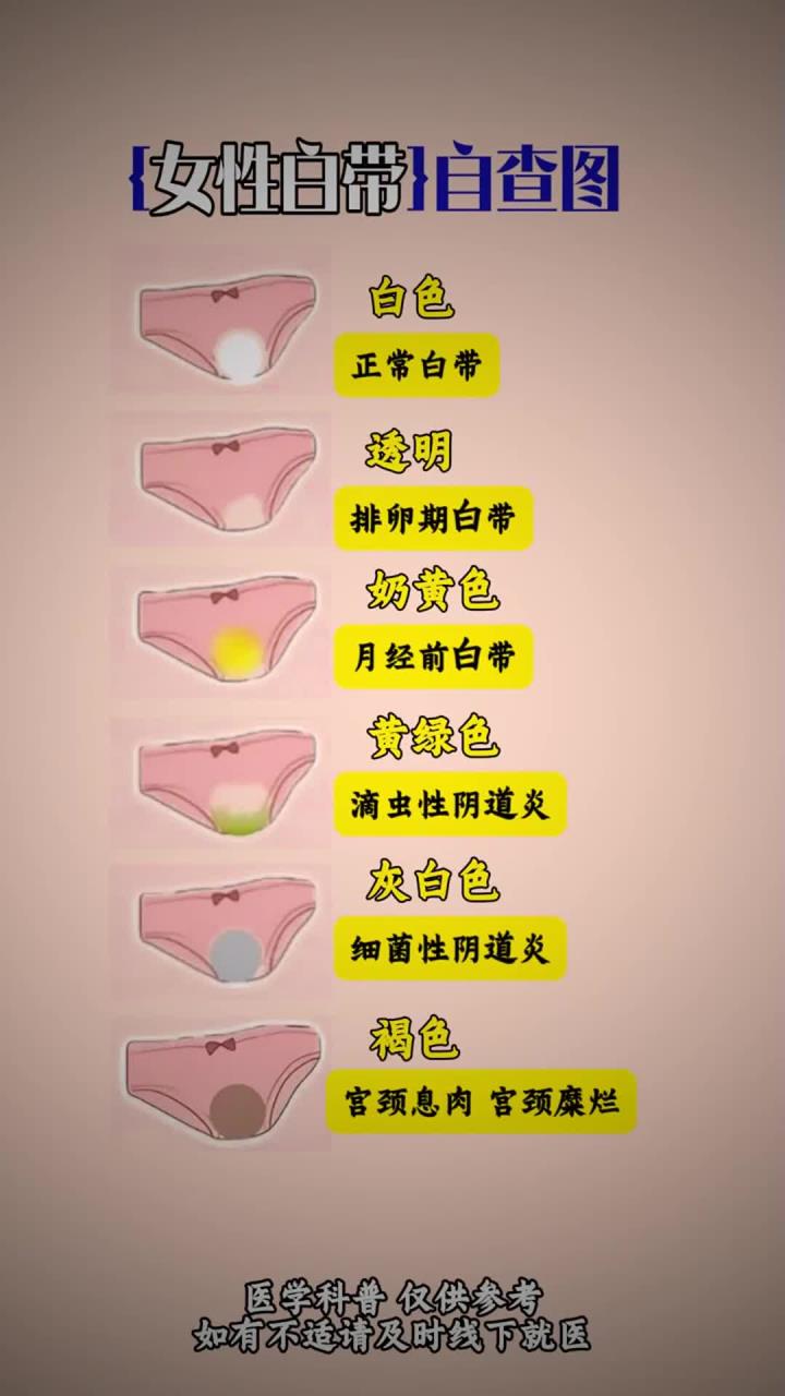 女性白带自查图