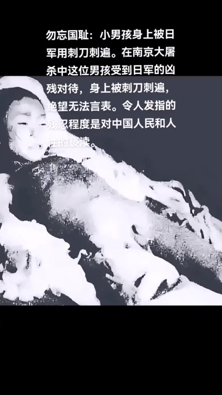 勿忘国耻:小男孩身上被日军用刺刀刺遍.在南京大屠杀中这位男