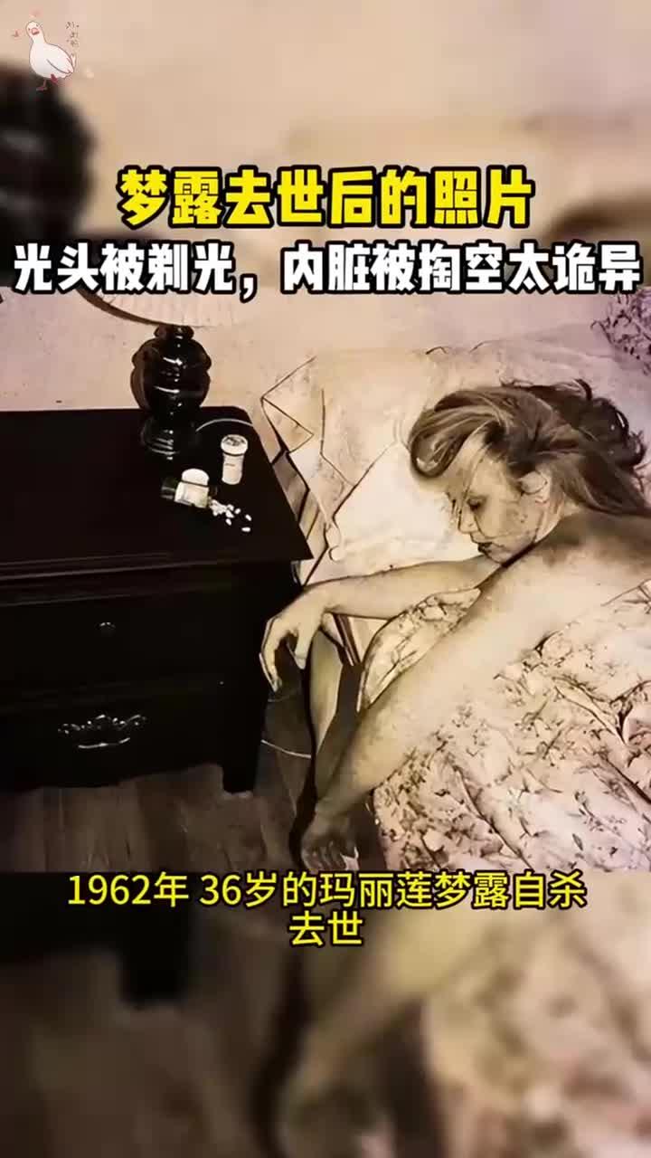梦露去世后的照片,牙齿掉光头发被剃,内脏被拿去研究化验