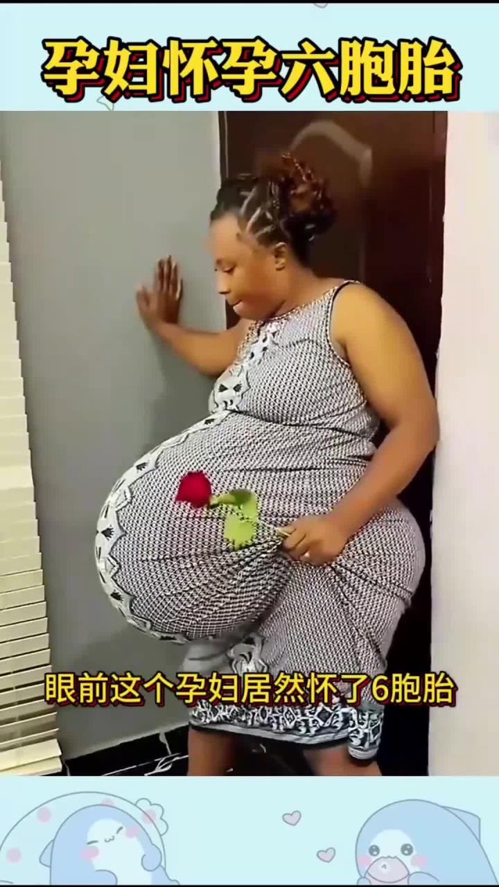 孕妇怀孕六胞胎,太不容易了