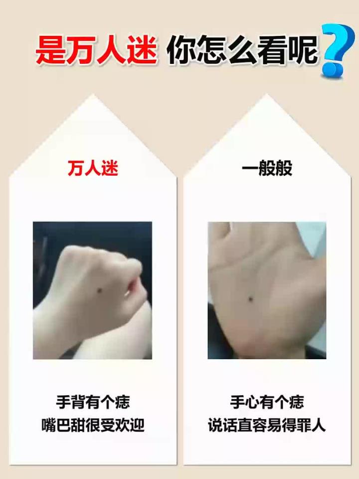 图一手背有颗痣嘴巴甜很受欢迎