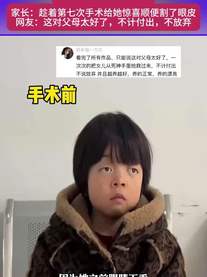 女孩患克鲁宗综合征发现眼睑下垂影响视力