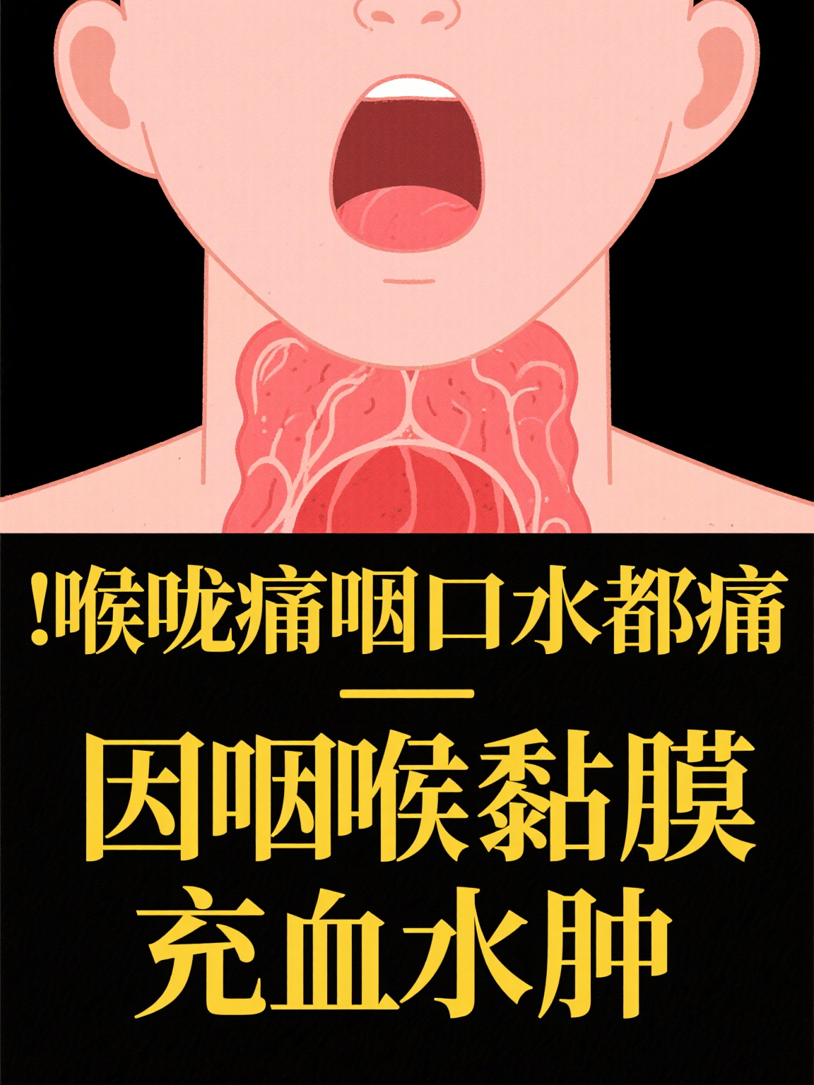  病毒性嗓子疼什么症状(病毒性嗓子疼吃什么药最管用)