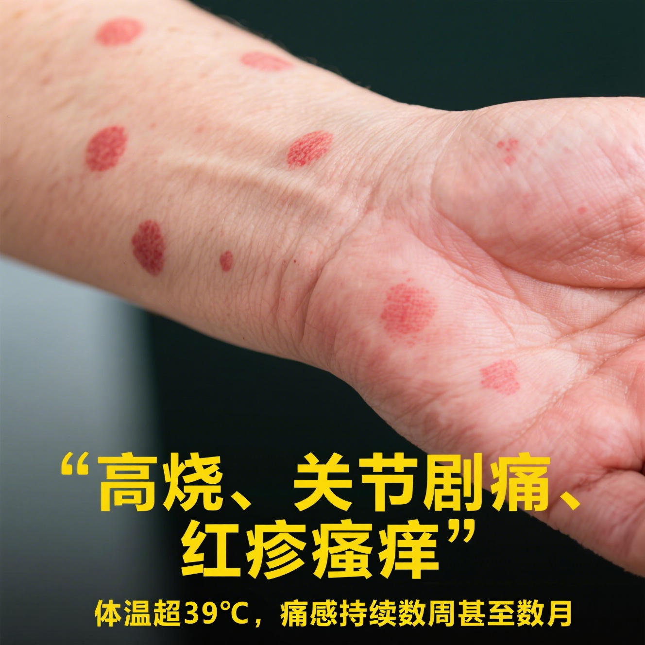  得了疫情有什么症状?(疫情得病有什么症状)