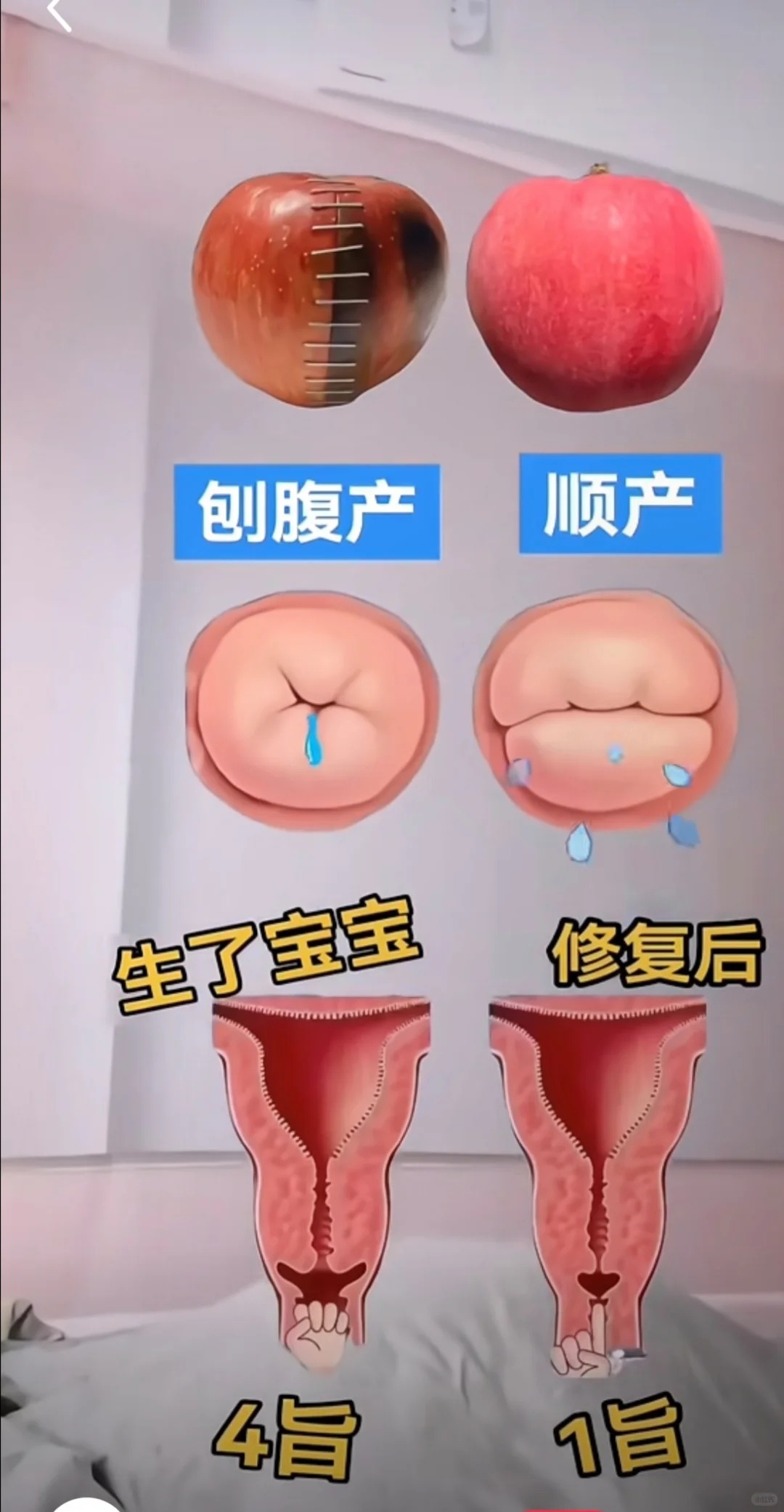 在第一阶段,子宫规律收缩会让产妇感到阵阵腹痛,就像浪潮不断袭来,宫