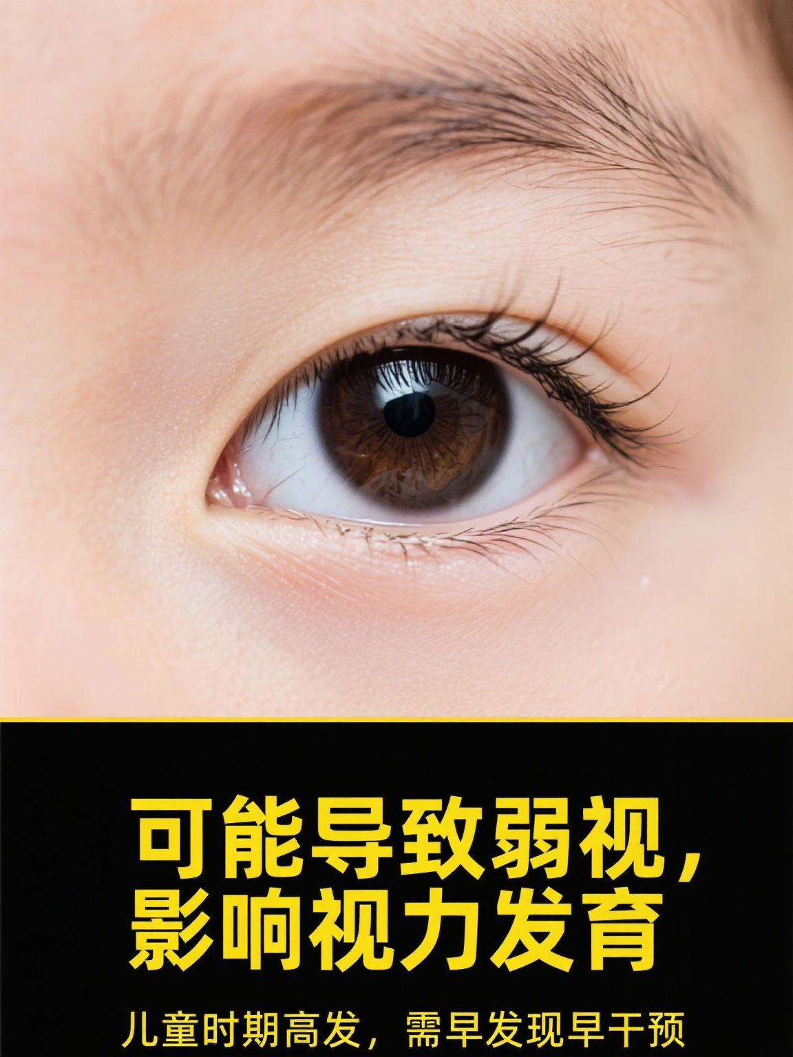 斗鸡眼在医学上称为内斜视,是指双眼视线无法同时聚焦在同一物体上