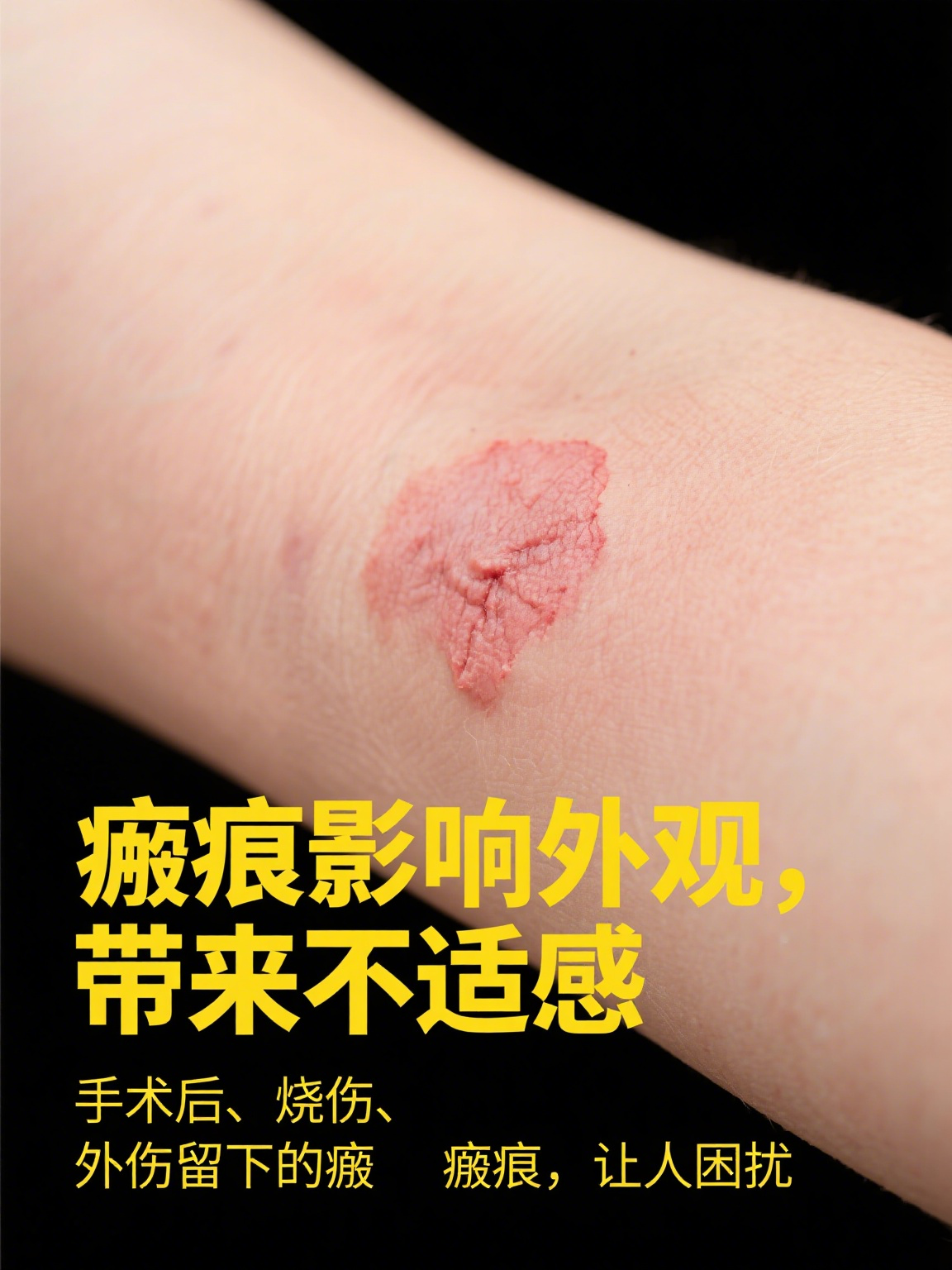 复方肝素钠尿囊素凝胶