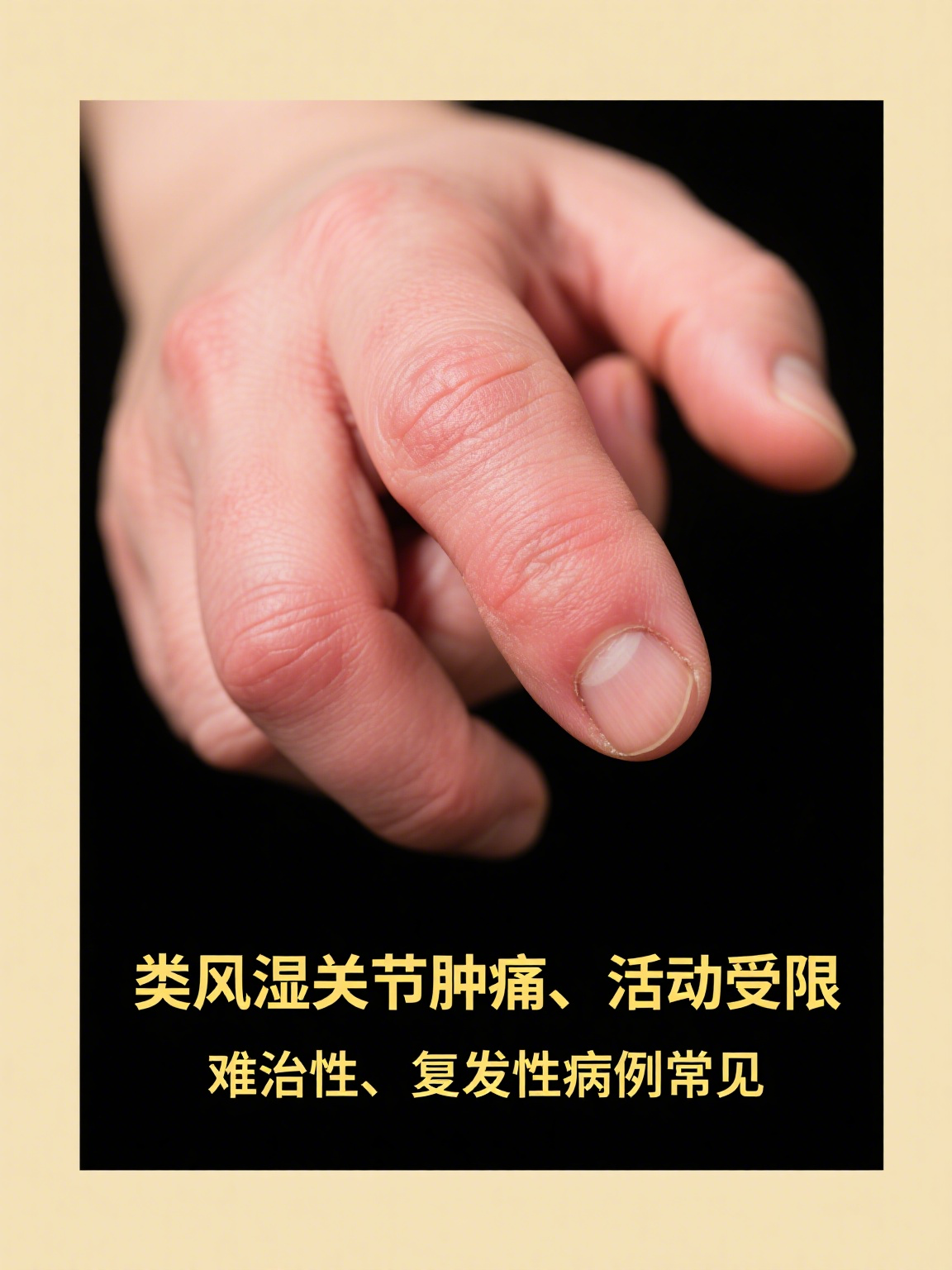西苑医院检查陪护加挂号复杂病例深度梳理,诊疗更精准的简单介绍 西苑医院检查陪护加挂号复杂病例深度梳理,诊疗更精准的简单介绍
