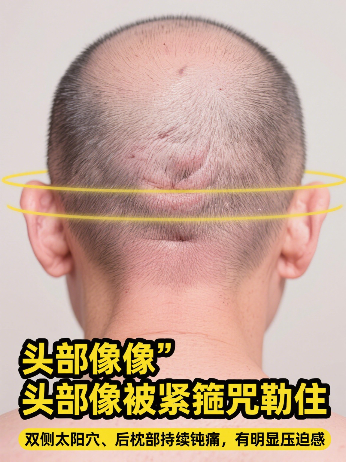 其最典型的症状是头部出现压迫感,紧箍感,就像头上套了个无形的紧箍咒