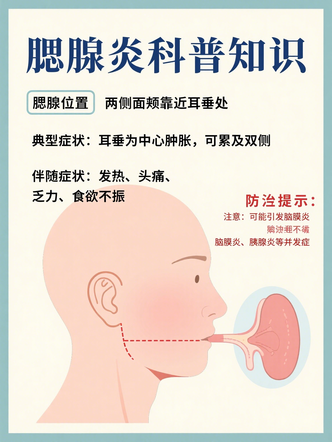 腮腺炎的准确部位图片和症状 腮腺,作为人体最大的唾液腺,就位于我们