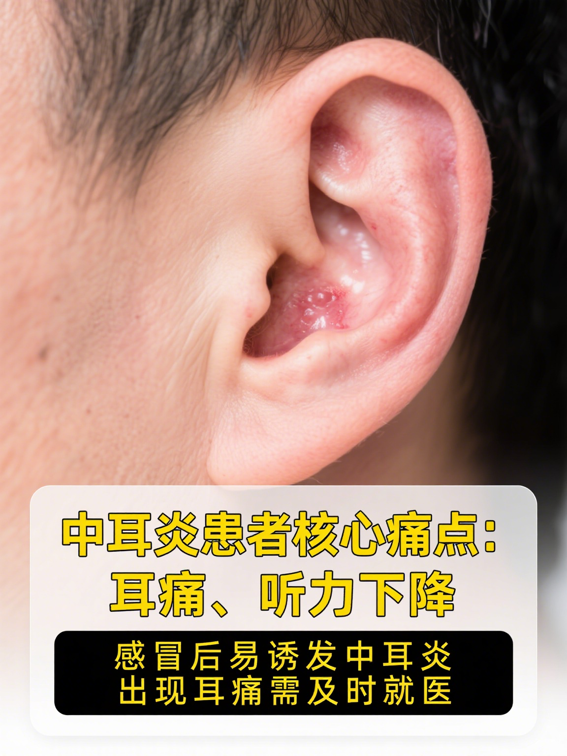 耳鼻喉科专科医院:守护你的五官健康